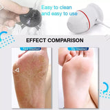Electric Foot Grinder - Callus Remover