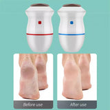 Electric Foot Grinder - Callus Remover